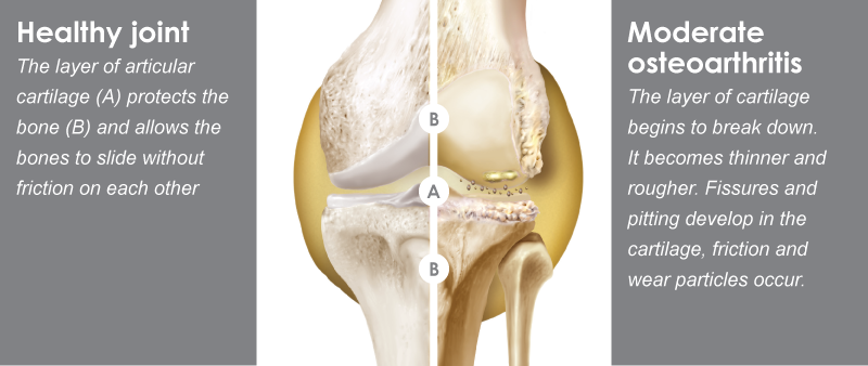 knee-website